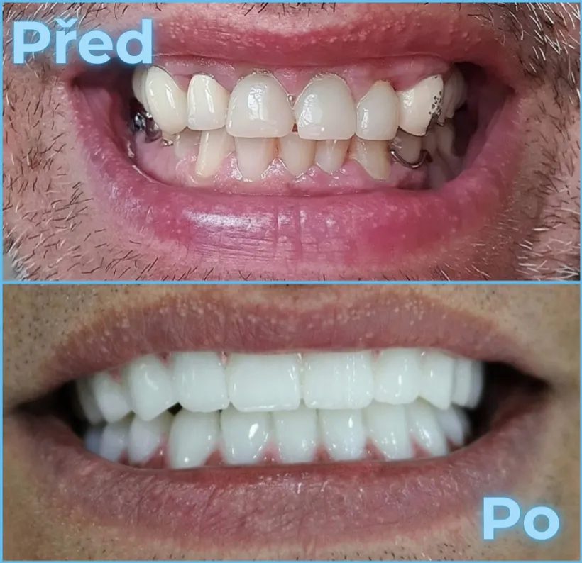 Před a po, klient 2