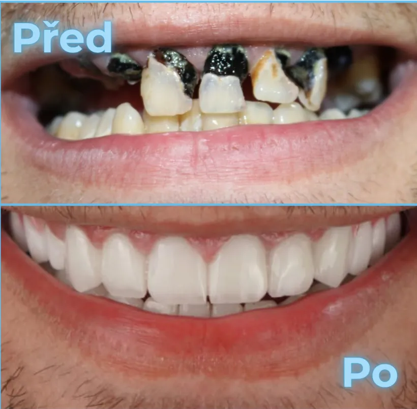 Před a po, klient 3