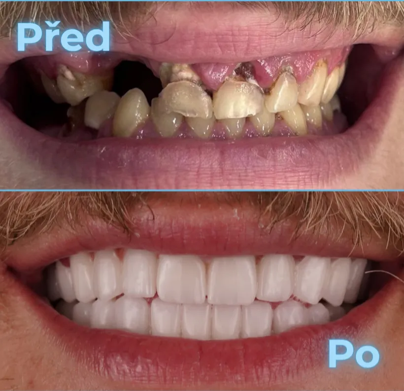 Před a po, klient 4