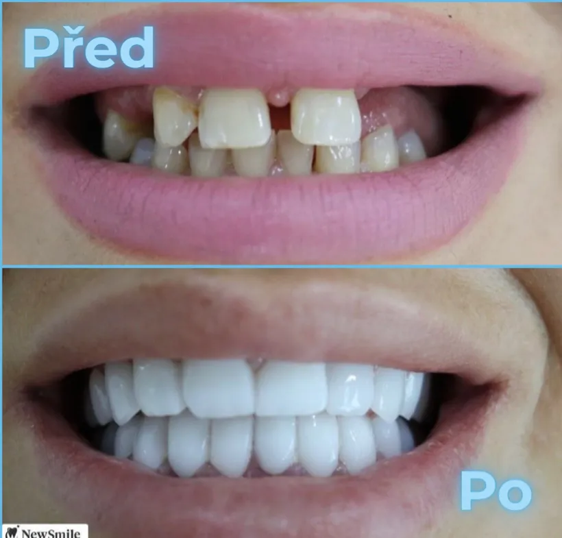 Před a po, klient 5