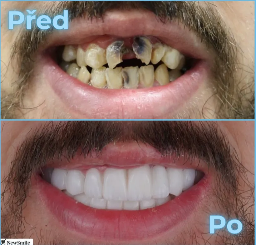 Před a po, klient 6
