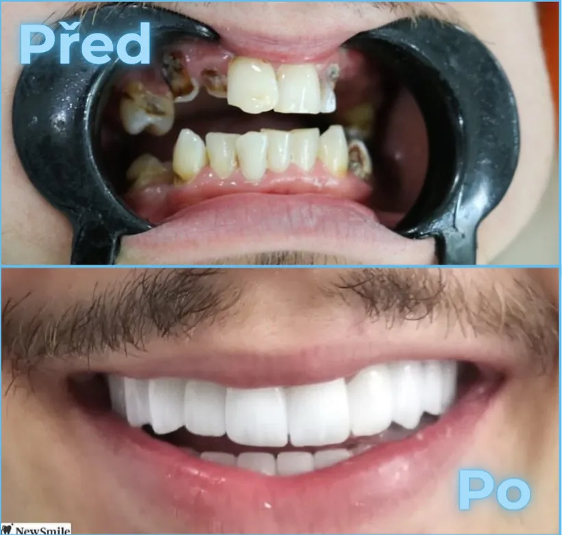 Před a po, klient 7